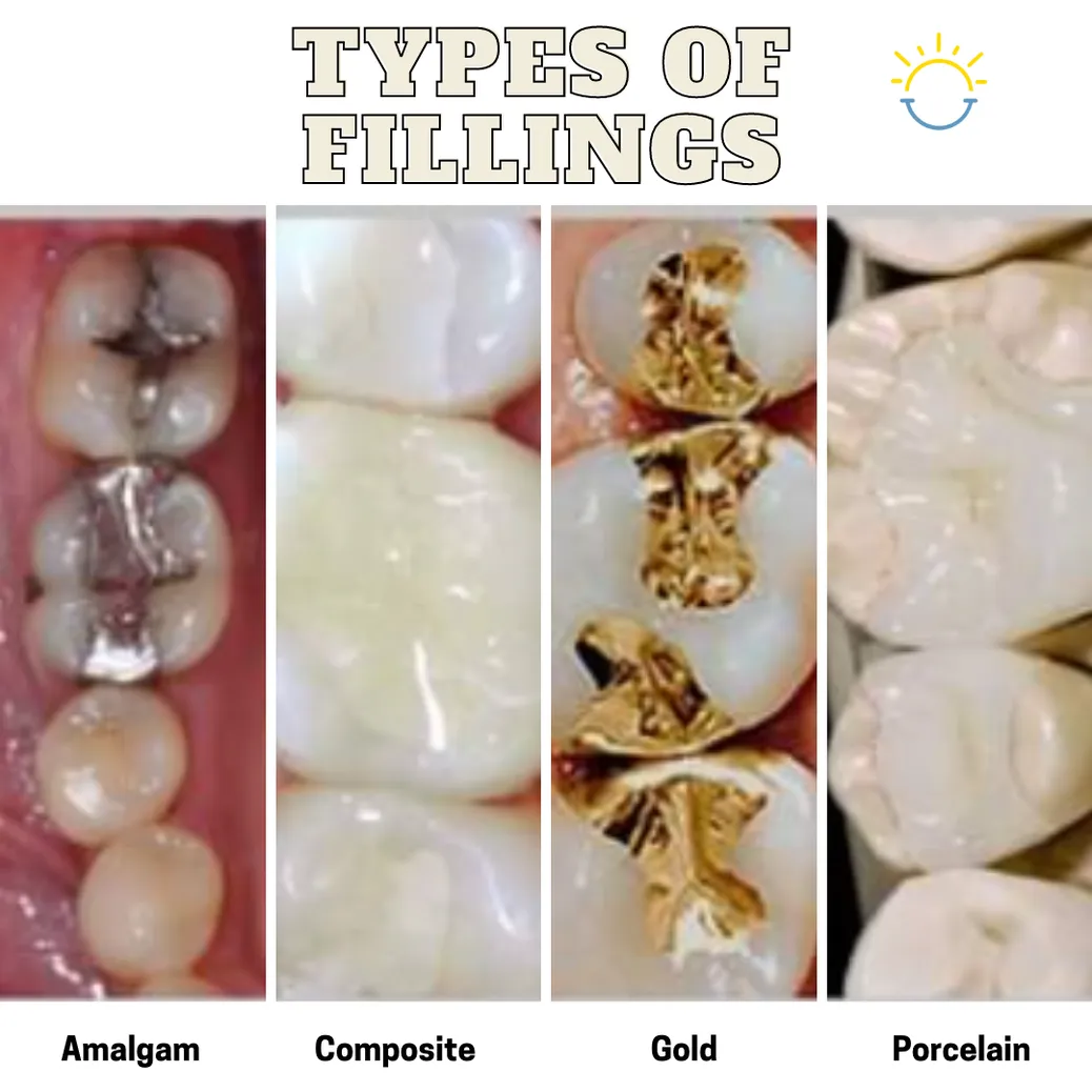 Types of store fillings