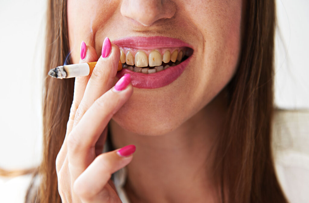 A smoker smiling, showing her nicotine-stained teeth.
