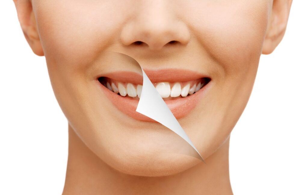 a person smiles, a layer showing their old, yellowed teeth is peeled back to reveal freshly whitened, bright teeth.
