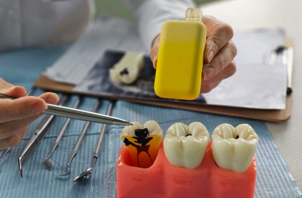Dentist holding a vape device and point to model of teeth with one that has internal decay.