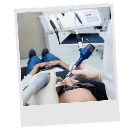 Sundance Dental Clinic Air Polish Gallery 4